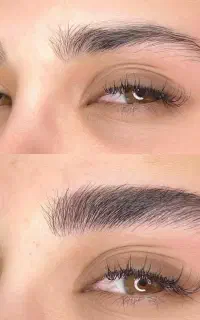 نیاز به مدل میکروبلیدینگ نچرال