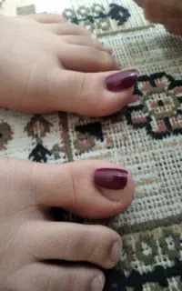 کاشت ناخن پا با تخصص ۱۰ ساله