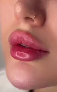 ژل بوتاکس فیلر جوانساز مزوابرو