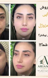 خدمات ویژه کلینیک پوست و زیبایی توسط پزشک
