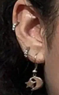 طلا گمشده