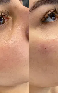 خدمات تخصصی پوست