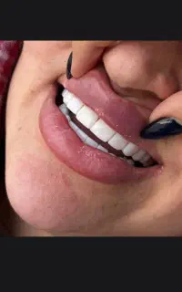 کلینیک دندان پزشکی با جشنواره تابستانی ایلام