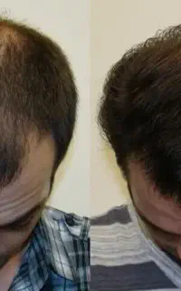 دیگه قرار نیست کچل شی چون درمانت اینجاست