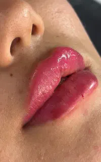 مرکز تخصصی ژل و بوتاکس کاشان
