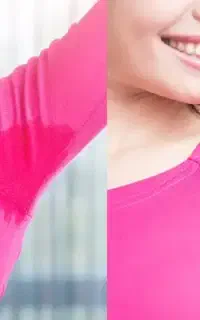 بوتاکس زیر بغل جشنواره تابستانی تخفیف استثنایی