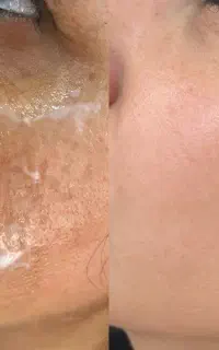 سفیدکنندگی و پی ار پی