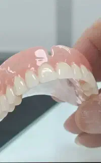 ساخت انواع دندان مصنوعی محرک و ثابت