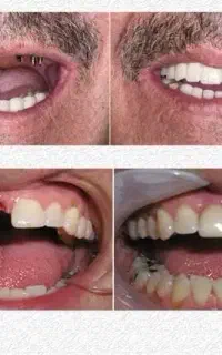 خدمات درمانی دندانپزشکی قراردادبابیمه تمام بانک ها