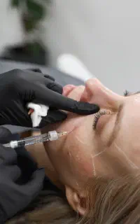 آموزش ژل ‌ و بوتاکس