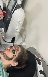 پاک کردن تتو کک و مک جوش