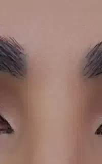 کاشت مژه هیدن تخفیف ویژه بدون آسیب
