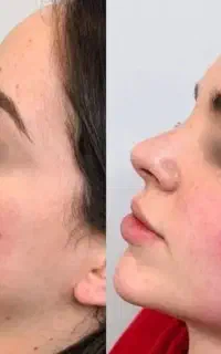 جشنواره فیلربادی هرسیسی۲۵۰.فیلر بیکینی ۳۵سیسی ۷۵۰۰