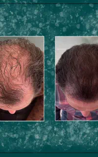 موهاتو توی سریع ترین حالت برگردون