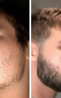 لایق ریشای خفنی