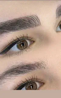 مدل وخدمات رایگان فیبروز ابرو تخصصی