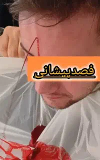 آموزش ومدرک معتبرحجامت‌فصدزالوماساژطب سوزنی
