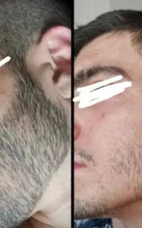 پرپشت شو