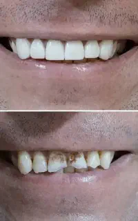 دندانپزشکی