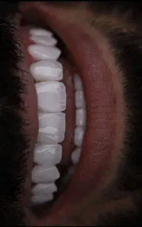 دندانپزشکی و ایمپلنت با شرایط اقساطی
