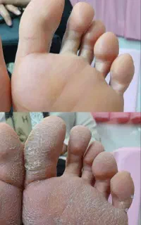 انجام خدمات کفسابی و پدیکور درمانی