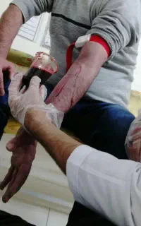 حجامت و فصد و زالودرمانی و بادکش و ماساژ درمانی