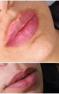 ژل \بوتاکس \لیزر مطب صدف (رویال سابق)