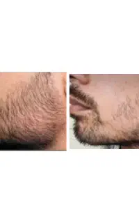 ریشات از موهات بلند تر میشه