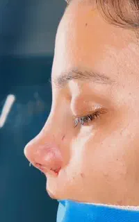 عمل زیبایی بینی و بادی
