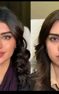 جشنواره،ژل،فیلر بادی تضمینی،مزوفیلرصورت تخصصی دقیق