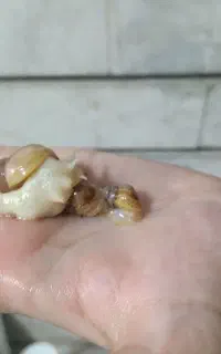 حلزون آلبینو