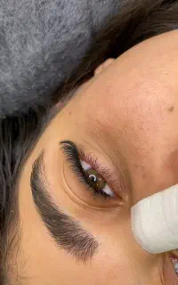 کاشت مژه هیدن( ریسه ای )