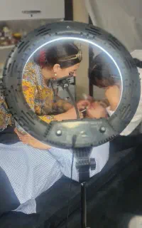 تزریق فیلر، و بوتاکس مزو،پی ار پی در کلینیک زیبایی