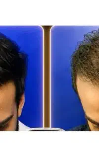 تارهایی که ضعیف شدن درست میشن
