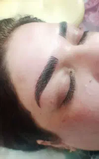 تخفیف شیدینگ لب. فیبروز. تتو صورت