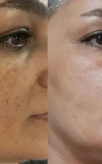 کرم هشت کاره تخصصی بیوممتیک