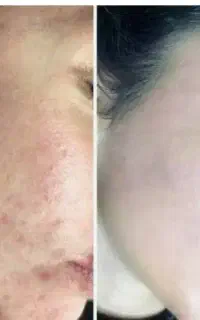 کرم سفید کننده صورت