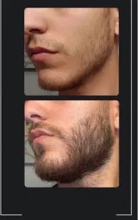 خداحافظی با کم پشتی ریشات