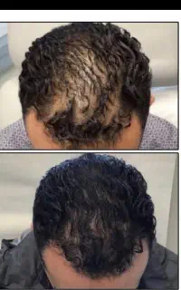 1ماهه پرپشتش کن