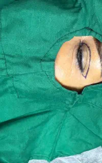 جوانسازی و فرم‌دهی صورت بلفاروپلاستی و سانترال لب