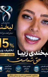 لمینت و کامپوزیت ونیر با ۱۵٪ تخفیف تابستانه+اقساط