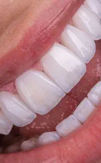 خدمات دندانپزشکی با قیمت استثنایی۳ روزه/کف قیمتی