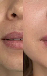 جشنواره ویژه مطب دکتر اشکان مرادی «آف ویژه»
