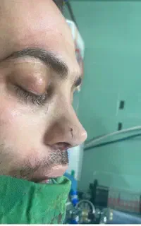 لیپو ساکشن فقط۷۵میلیون