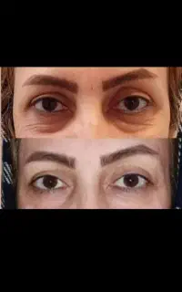 کرم بیوممتیک جوانساز جهانی