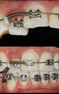 دندانپزشکی اقساط (فقط ارتودنسی و کامپوزیت) هفتگی