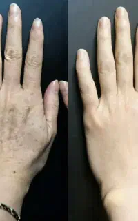 صدلک