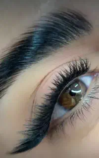 کاشت  موقت هیدن