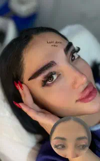 جشنواره کاشت مو و ابرو با و بدون جراحی