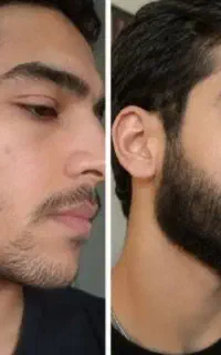 کوسه بودن ممنوع